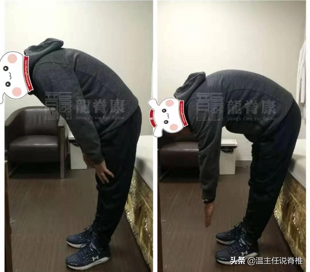 一弯腰胸就痛什么原因,弯腰右腰后侧痛是什么原因