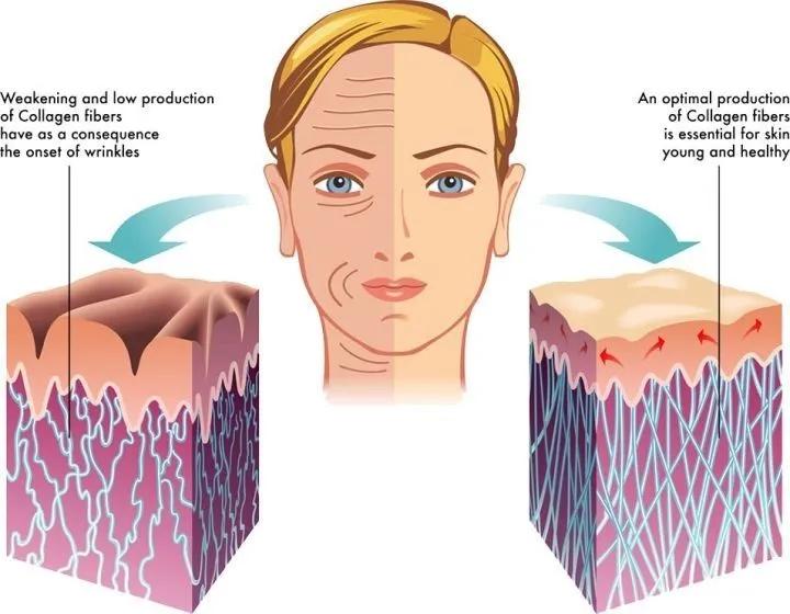 如何最高效补充胶原蛋白,重组胶原蛋白多效修护副作用