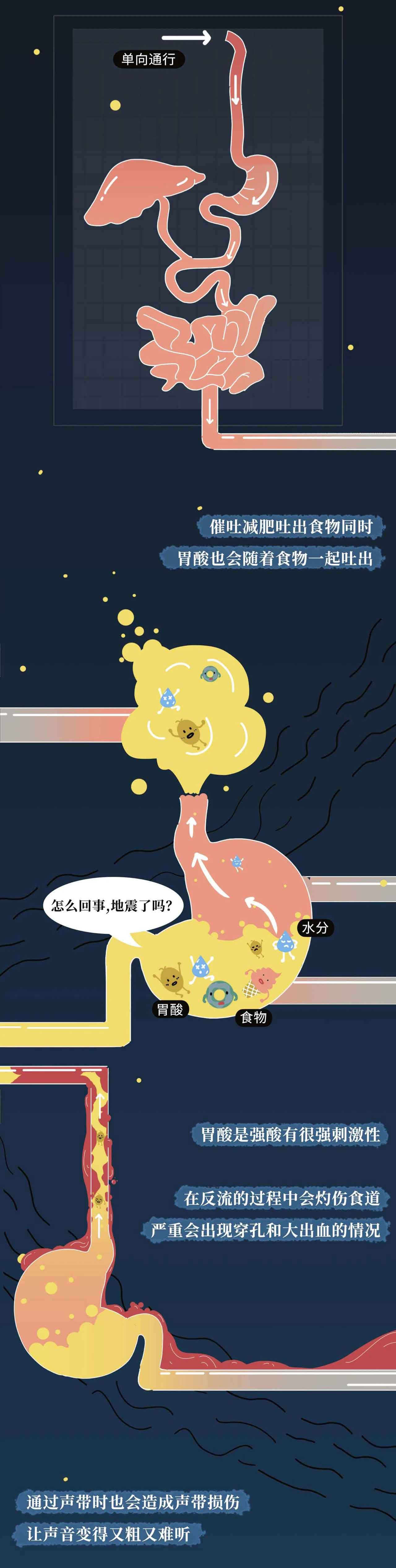 催吐,外挂般的减肥方式?吃的是欲望,吐的是灵魂