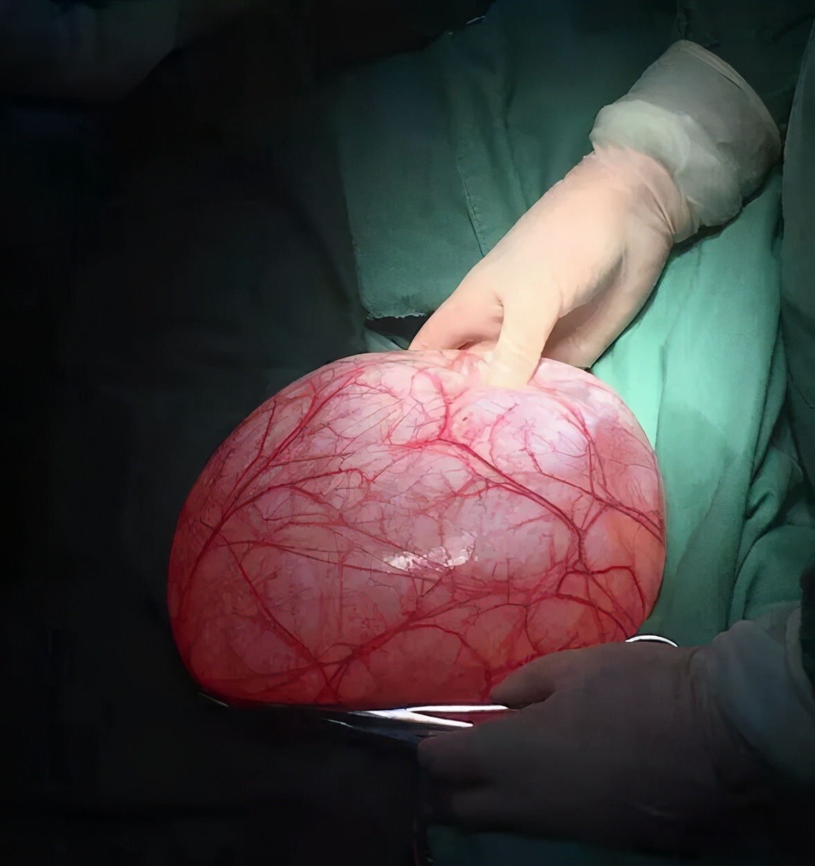 医患暖心服务故事,优质服务医患和谐