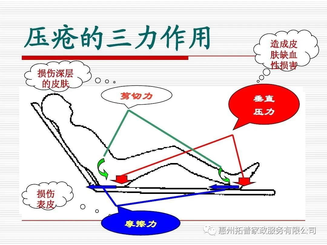 卧床老人一天护理流程,怎样护理卧床老人流屎