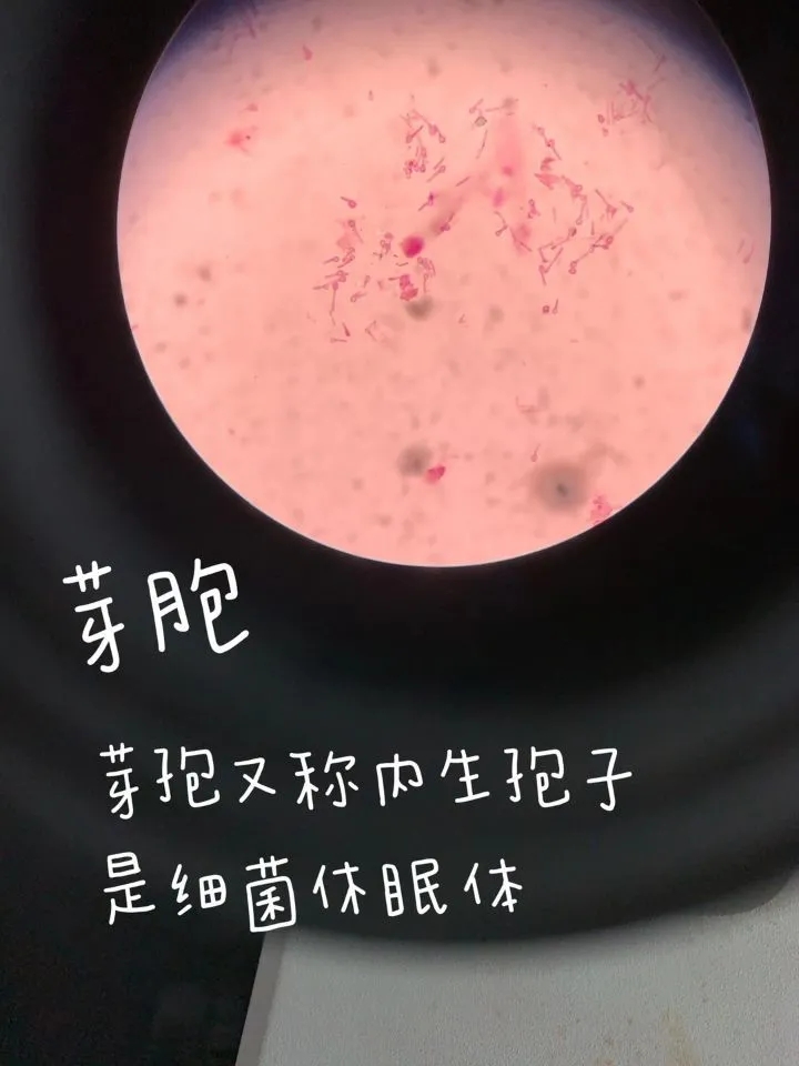 医学生学习打卡做题,医学生学习成果检验视频