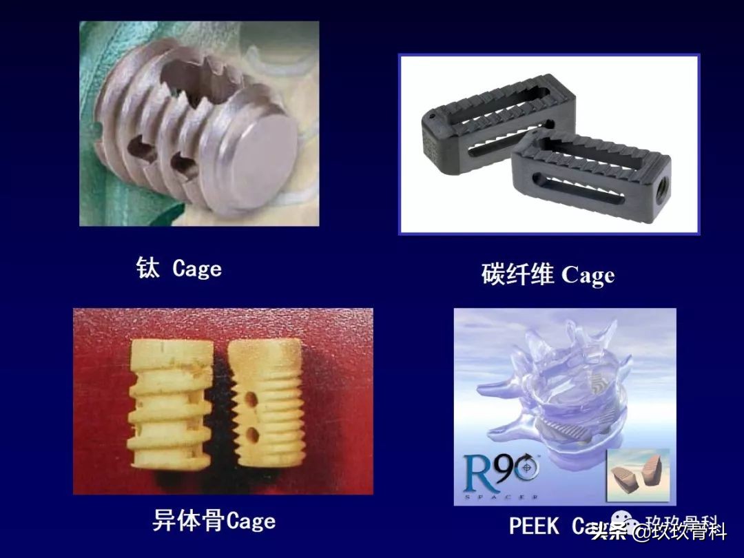 腰椎不稳最坏的结果,腰椎不稳的最佳治疗方法