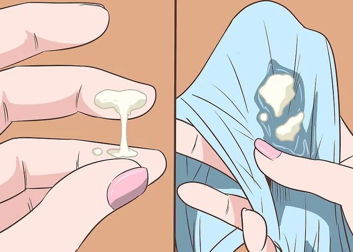 念珠菌阴道炎患者白带症状,念珠菌性阴道炎患者白带症状