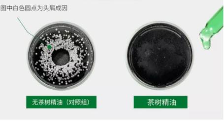 头发蓬松茶树油洗发水,油头救星澳洲茶树洗发水