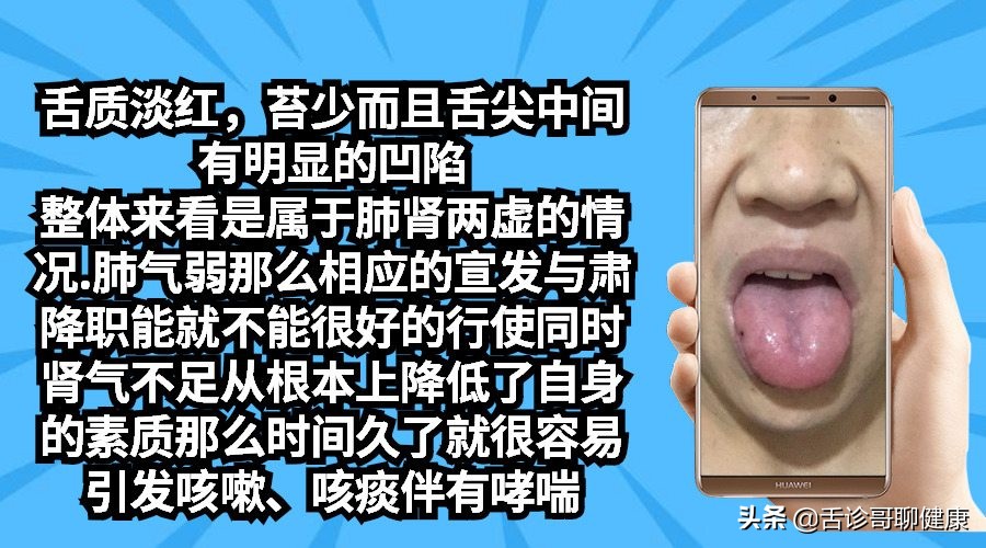 舌诊歌舌象分析与感悟,抖音舌诊哥舌象分析