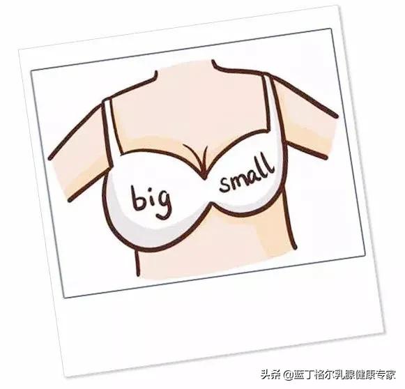 胸的大小左边不一样怎么办,两边胸的肿块不一样大