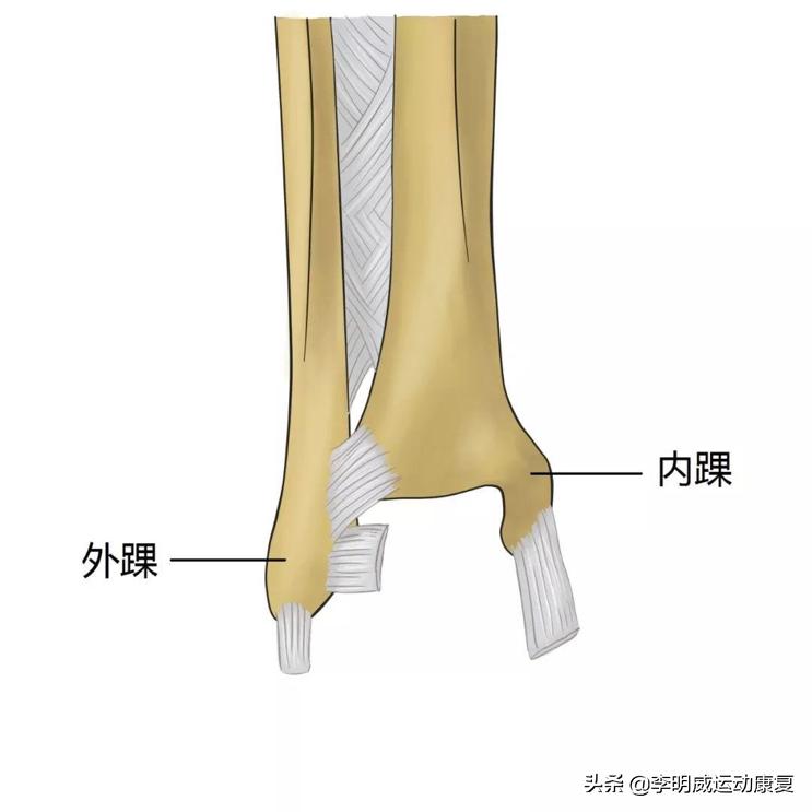 习惯性崴脚啥原因,习惯崴脚怎么办
