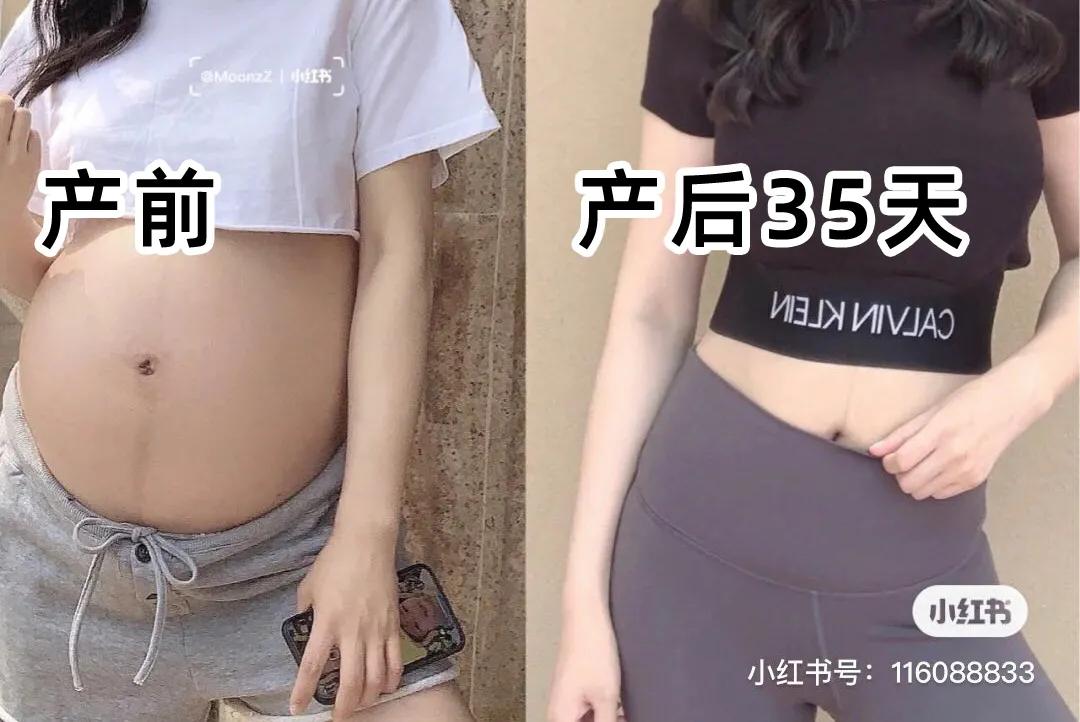 “卸货”并不是终点，产后康复问题不容忽视