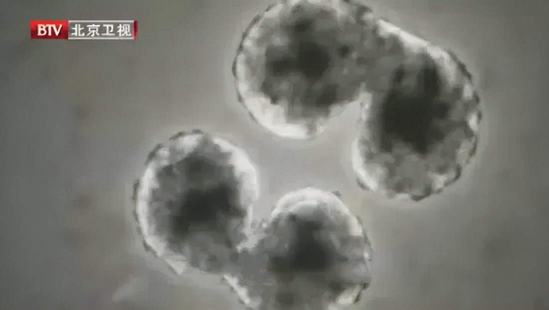 中国香港连续7年获全球最长寿地区冠军!这6大“养生秘诀”告诉你