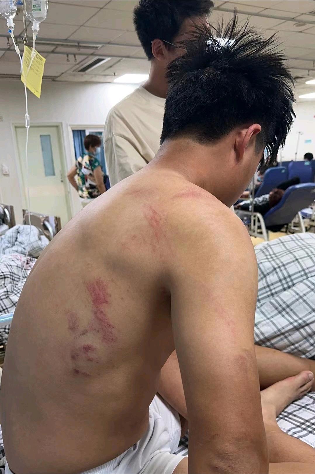 湖北大学冲突事件后续打人者,浙江高校足球打架冲突