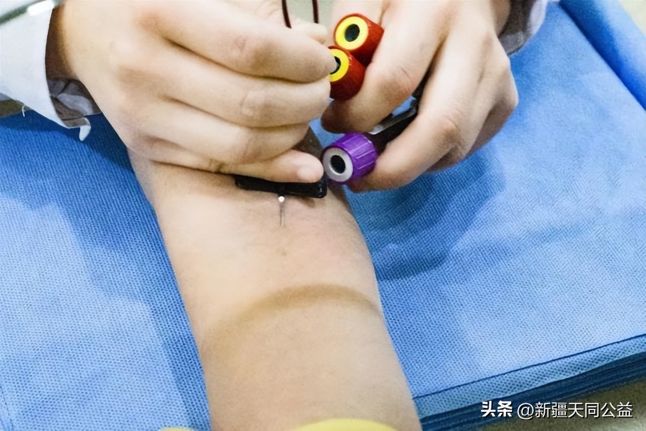 真实艾滋病急性期自述,无意感染艾滋病的患者自述