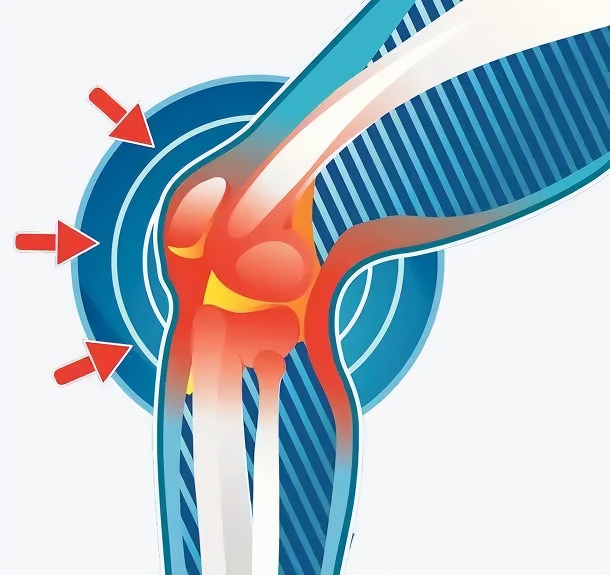 7岁小孩子腿型不好看怎么纠正,三岁小孩腿型需要矫正吗