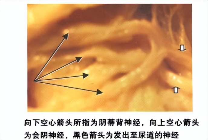 阴蒂痛的病因及对策