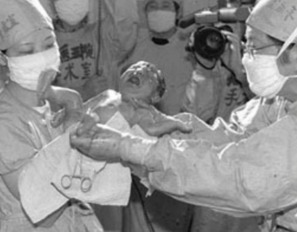 第一例试管婴儿郑萌珠,大陆第一例试管婴儿郑萌珠