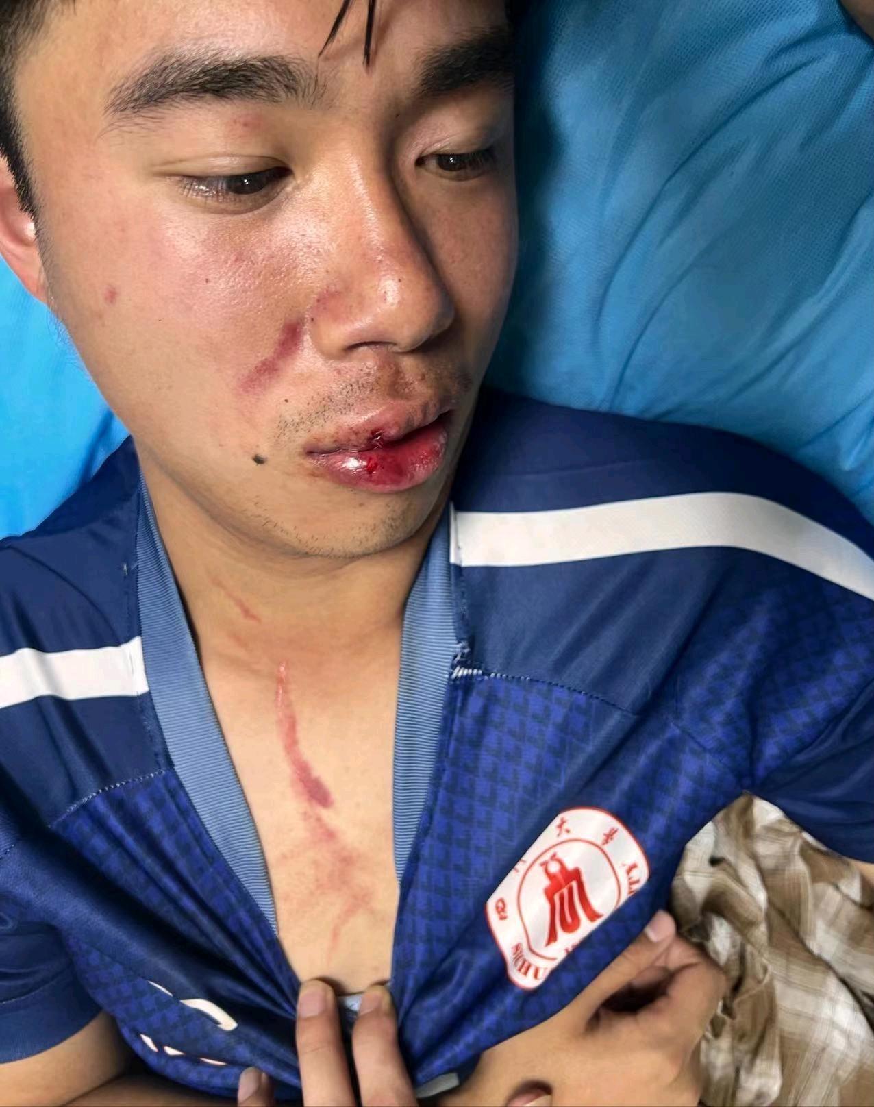 湖北大学冲突事件后续打人者,浙江高校足球打架冲突