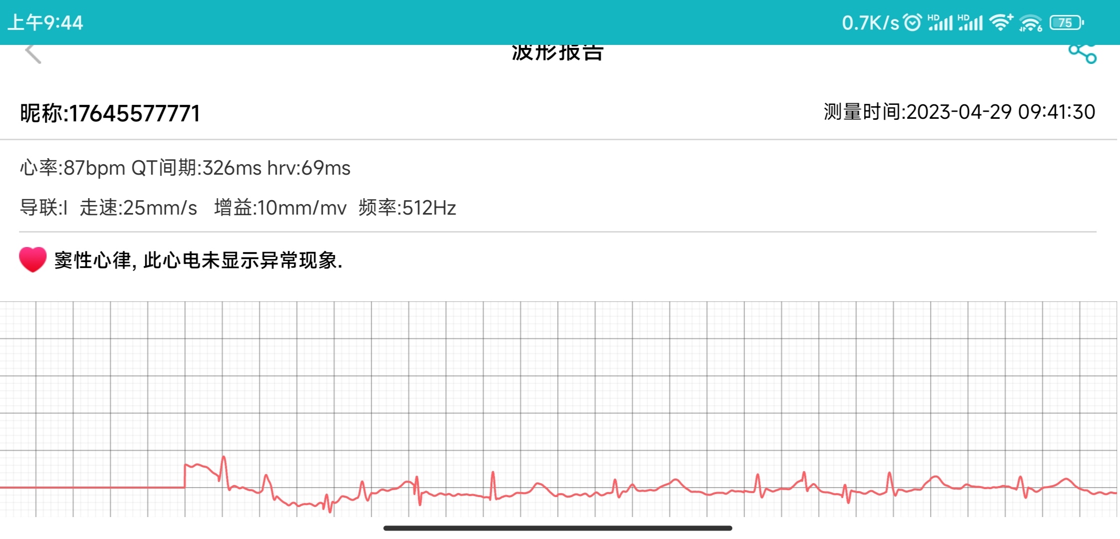 didoe55智能手表靠谱吗,dido智能手表哪款健康监测最好